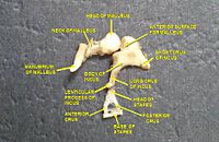 Auditory ossicles from a deep dissection of the tympanic cavity Slide1ghe.JPG