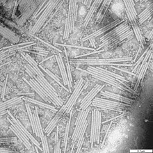 Wendell Stanley's crystallization of tobacco mosaic virus as a pure nucleoprotein in 1935 convinced many scientists that heredity might be explained purely through physics and chemistry. TMV virus under magnification.jpg