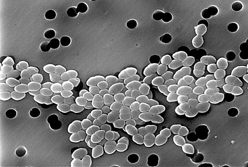 Vancomycin Resistant Enterococcus. enterococcus wiki