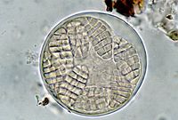 Bolvomige ascus met 8 muriforme ascosporen van Arthothelium spectabile