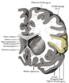 Sezione coronale (frontale) attraverso il corno anteriore del ventricolo laterale. La circonvoluzione frontale inferiore è evidenziata in giallo.