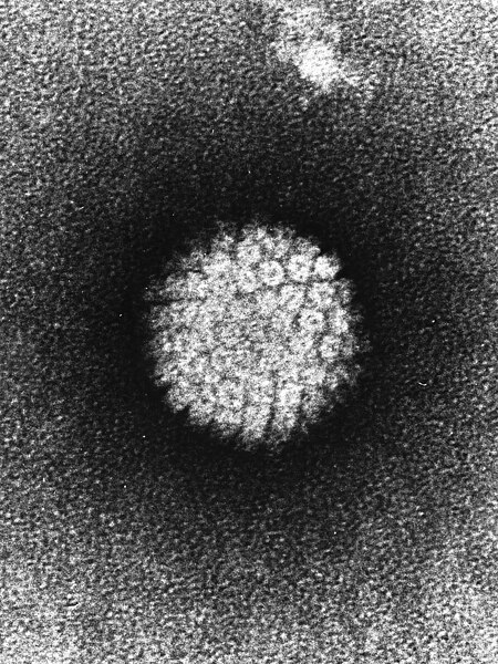 File:Papilloma Virus (HPV) EM.jpg
