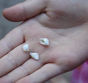 An eight-year old's deciduous teeth.