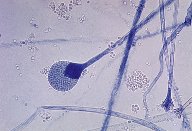 File:Mature sporangium of a Mucor sp. fungus.jpg