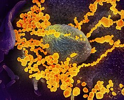 SARS-CoV-2 virions emerging from a human cell