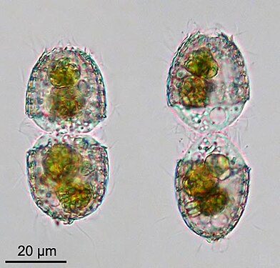 Coleps sp., phase précoce (gauche) et tardive (droite) de la division cellulaire