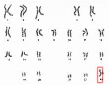 Человеческий мужской кариотп высокого разрешения - Хромосома X.png