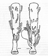 Anatomischer Aufbau der paraurethralen Drüsen einer Frau mit Urethra – Meatus urethrae externus (Bild unten) und den von dorsal bzw. ventral einmündenden Drüsenausfuhrgängen.[35]