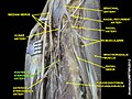 Posterior interosseous artery