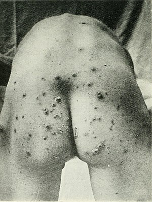 The British journal of dermatology (1888) (14584388810).jpg