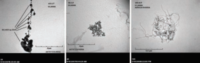 Три изображения с помощью микроскопа в оттенках серого, расположенных горизонтально. Два левых показывают скопления черных пятен на сером фоне, а правые - скопление запутанных волокон.