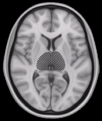 English: Thalamus. Part of the brain. MRI image.