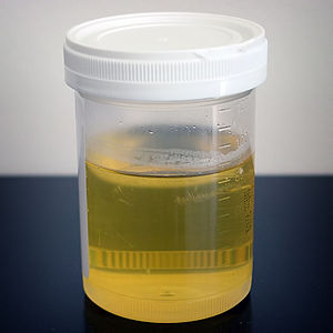 Sampel urin