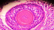 Human primary ovarian follicle viewed by microscopy