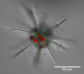 Phaeocystis symbionts within an acantharian host.png