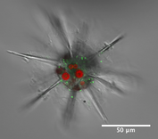 Phaeocystis symbionts within an acantharian host.png