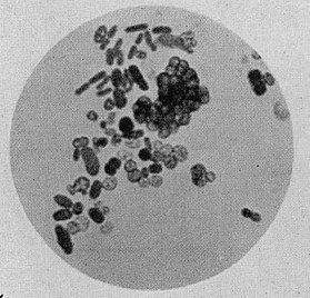 Células de Azotobacter sp. tinguidas con hematoxilina de ferro de Heidenhain, a 1000 aumentos.