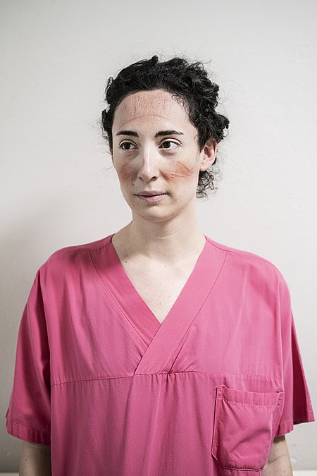 پرتره Michelle Brozzi, دکتر بیهوشی (دنیاگیری کروناویروس)