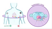 Fichier : Electrocardiography Basics.webm