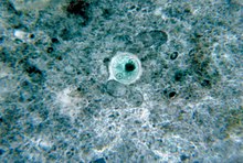 Entamoeba histolytica 01.jpg