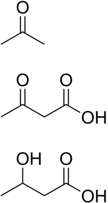 Химическая структура трёх кетоновых тел: ацетон, ацетоуксусная, и бета-оксимасляная кислоты[1]