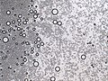 Stärkekörner (Amyloplasten) aus dem Speichergwebe von Solanum tuberosum