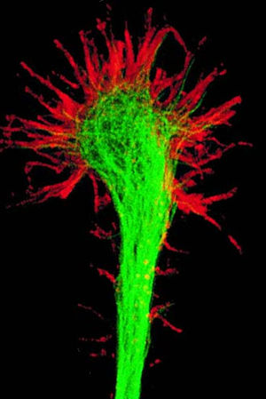 Image of a fluorescently-labeled growth cone e...