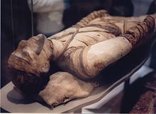 Egyptian mummy in the British Museum - tubercular decay has been found in the spine. Mummy at British Museum.jpg