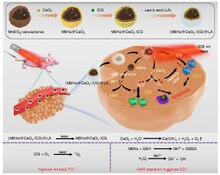 The scheme of fabrication process and therapeutic mechanism of thermo-responsive (MSNs@CaO2-ICG)@LA NPs for synergistic CDT/PDT with H2O2/O2 self-supply and GSH depletion Open source and reduced expenditure ROS generation strategy.pdf