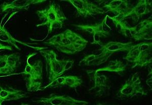 Immunofluorescenza che mette in evidenza gli astrociti - Foto Wikipedia