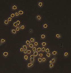 Hybridoma cells grown in tissue culture. The image shows a single clone of cells each of which is producing large amounts of a specific monoclonal antibody which the cells secrete and which can be readily purified from the culture media. Hybridoma cells grown in tissue culture.jpg