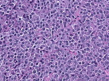 Description de l'image PRL HE histology.jpg.