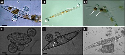 Chytrid parasites of marine diatoms. (A) Chytrid sporangia on Pleurosigma sp. The white arrow indicates the operculate discharge pore. (B) Rhizoids (white arrow) extending into diatom host. (C) Chlorophyll aggregates localized to infection sites (white arrows). (D) & (E) Single hosts bearing multiple zoosporangia at different stages of development. The white arrow in panel (E) highlights branching rhizoids. (F) Endobiotic chytrid-like sporangia within diatom frustule; bars = 10 mm . Chytrid parasites of marine diatoms.jpg