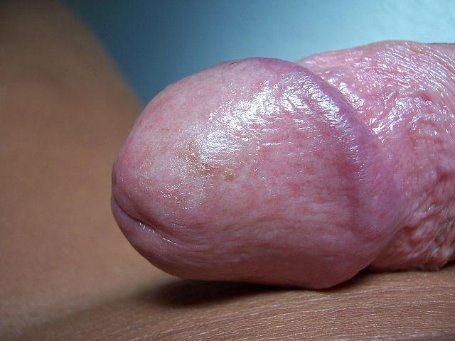 FileGlans Penis CloseUpJPG