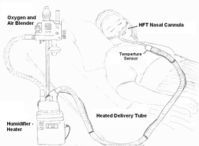 HFT diagram.png