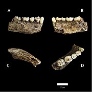 (A,B,C,D) Vistas de um maxilar inferior