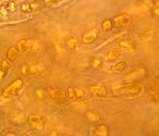 地衣Pyrenocollema halodytes，其中含有真菌菌丝的蓝藻Hyella caespitosa。