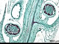 Micrograph of the strobilus of Lycopodium sp., showing spores borne in sporangia