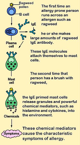 Image:Mast cells.jpg