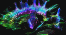 Трактографія людського мозку у бічній проекції
