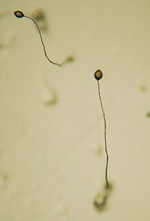 Dictyostelium discoideum