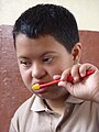 Nepalese child with Down Syndrome practicing oral health during an oral health promotion activity