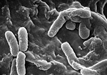 Pseudomonas aeruginosa elektronmikroskoobist vaadelduna