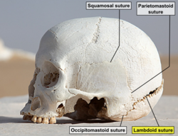 WhiteDesertSkullCropped - Lambdoid suture.png