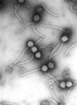 Virus - Gamma phage