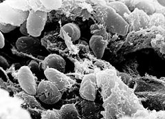 Сканиращ електронен микроскоп, показващ колония от бактерии Yersinia pestis в предната част на червото на инфектирана бълха