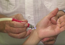 Application of blue light in the acupuncture's "60th point of the lung channel" during a colorpuncture session.