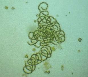 Cyanobacteria Dolichospermum crassum