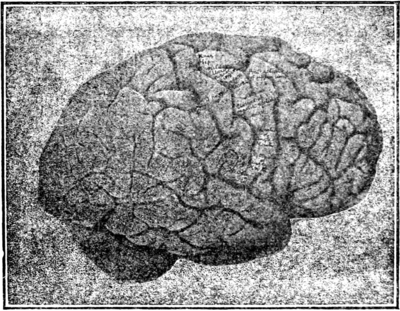 1907 image of a brain