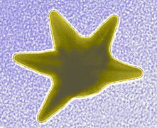 TEM image of a star-shaped nanoparticle prepared by NIST